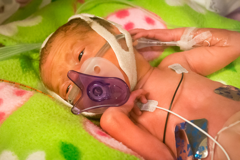 baby heart rate premature birth
